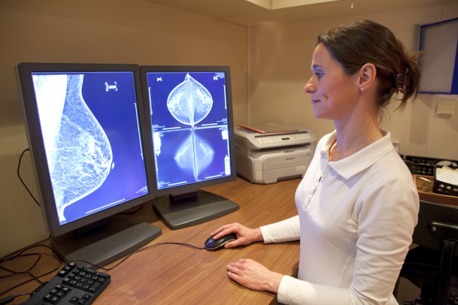 Doctor radiolog revizuind rezultatele mamografiei
