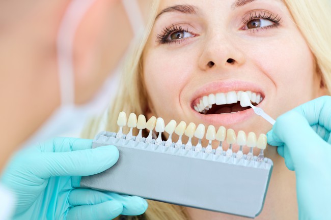 femeie cu implant dentar