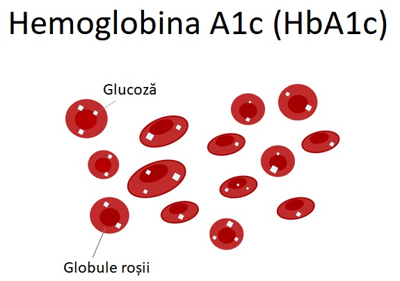 Imagine grafică cu hemoglobină glicolizată