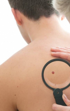 De ce sunt femeile mai afectate de epidemia de cancer de piele decat barbatii