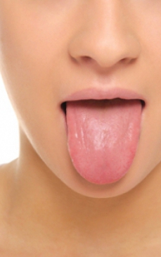 Bube pe limba: cauze, simptome si tratament