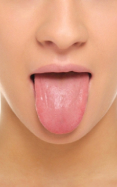 Ce inseamna cand ai pete pe limba