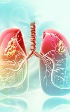 Astm bronsic alergic: simptome si tratament