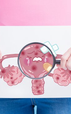 Cancerul cervical - simptome, diagnostic si tratament