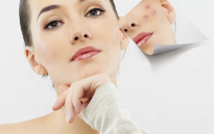 Top 5 fonduri de ten destinate pielii afectate de acnee