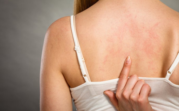 Eczeme ale pielii: cauze, simptome și tratament