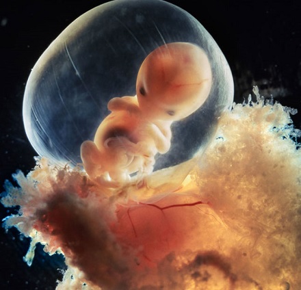 Bebelusi In Burta Imagini Nastere