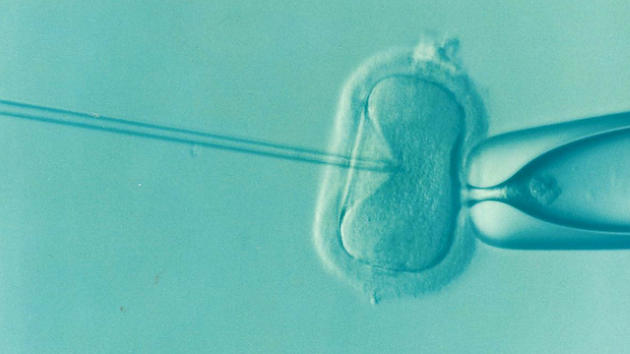 reprezentare vizuala pentru procedura de fertilizare in vitro (fiv)