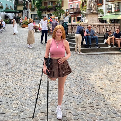 Andreea Anita, tanara de 27 ani cu cancer, careia i s-a amputat un picior, imbracata cu top roz si fusta scurta in carouri, sprijinindu-se intr-o carja, in timp ce se afla in apropierea unei statui intr-o piateta plina de oameni in timpul unei vacante in strainatate