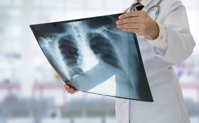 Medic cu radiografie a plămânilor