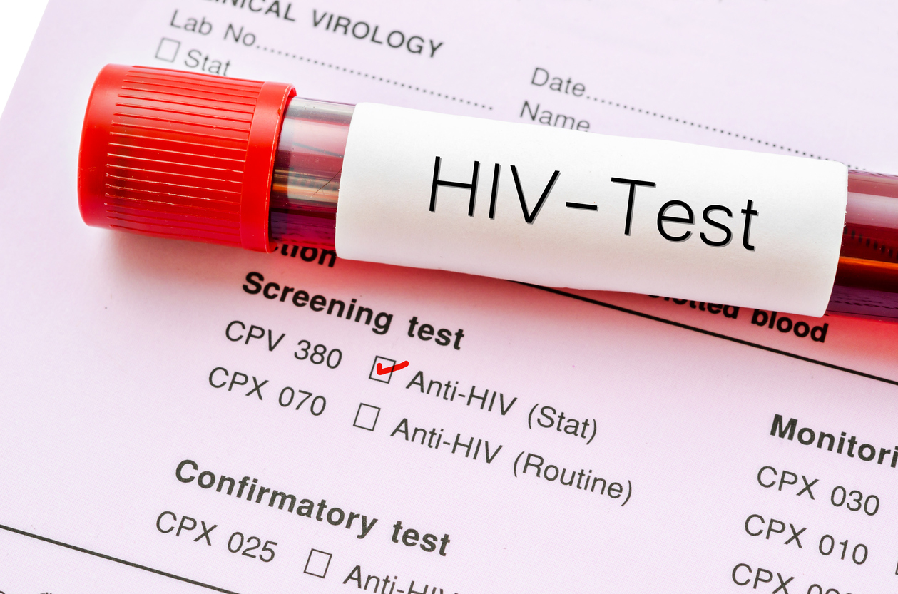 test HIV