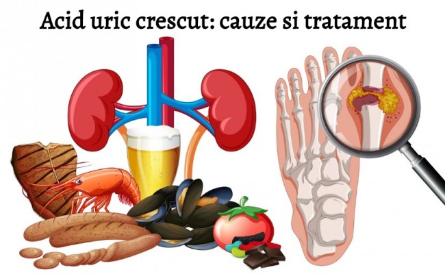 Alimente bogate in purine si guta formata de la acidul uric crescut