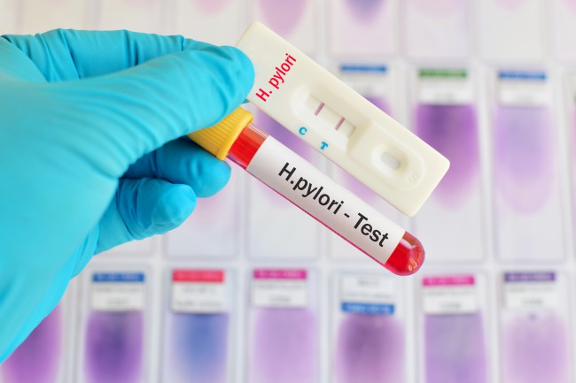 Eprubeta test sange helicobacter pylori