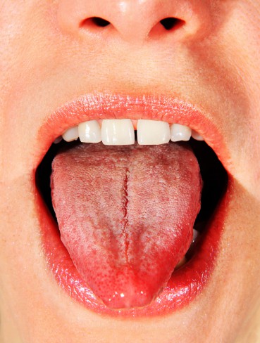 Gura de femeie cu limba crapata