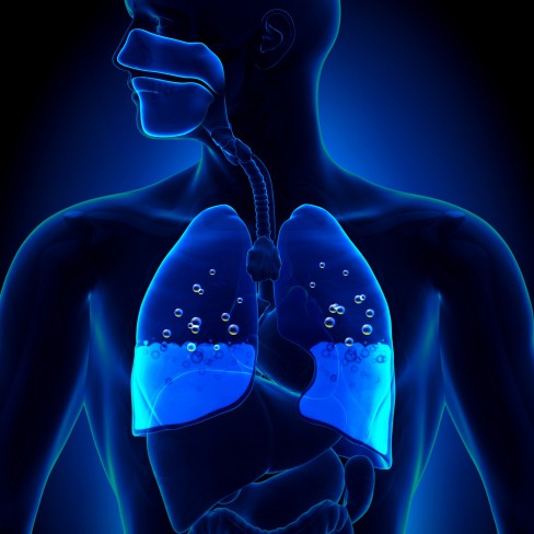 Edemul pulmonar