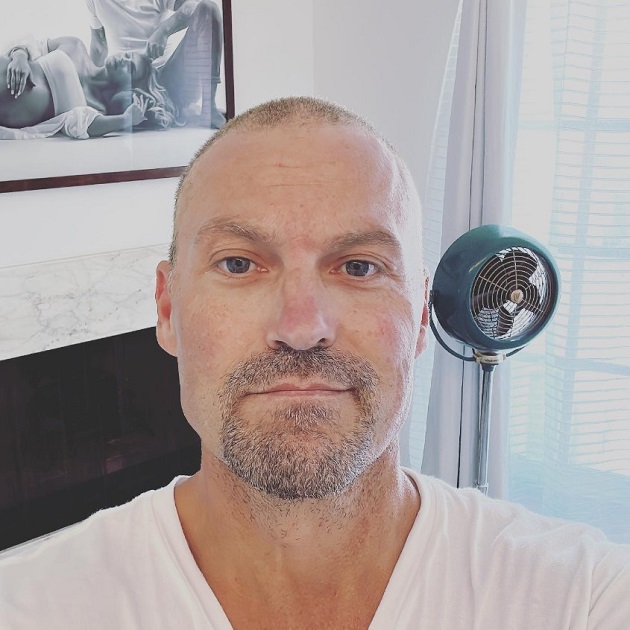 Brian Austin Green după multiple tratamente