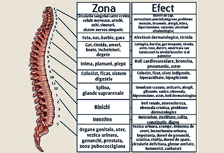 zone cu dureri de spate osteocondroza ameliorează durerea