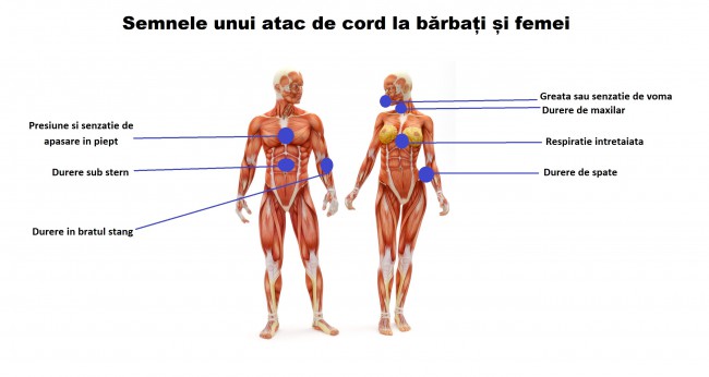 atac de cord