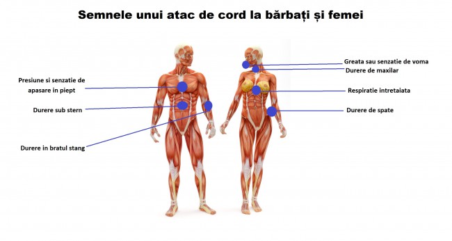 atac de cord