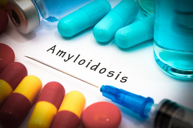 diagnostic scris de amiloidoza alaturi de pastile pe fundal alb