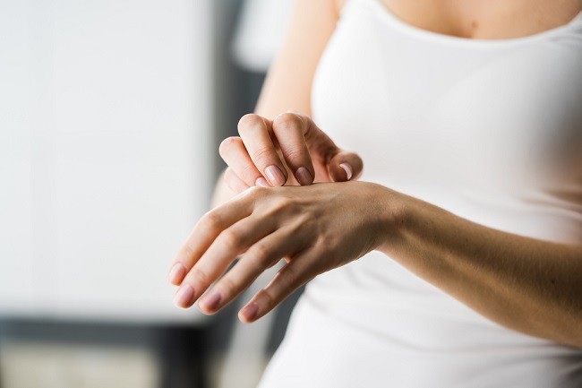 femeie care sufera de mancarimi de piele pe brat