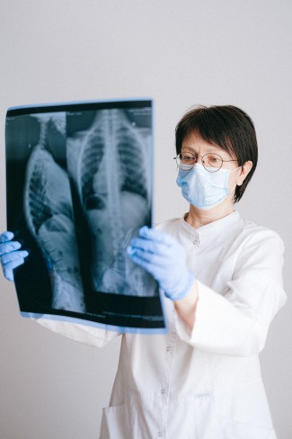 doctor cu masca care priveste radiografii ale unui plaman