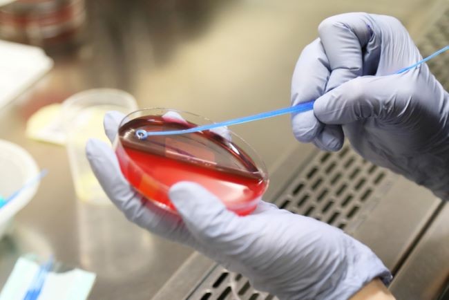 doctor care introduce un test dipstick intr-o proba de urina la laborator