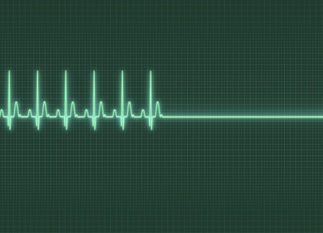 monitor ekg