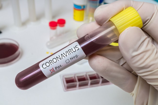 test coronavirus