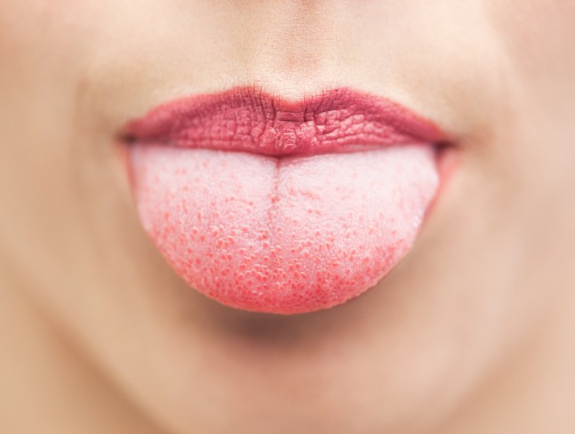 examinare orala pentru depistarea ciupercii pe limba