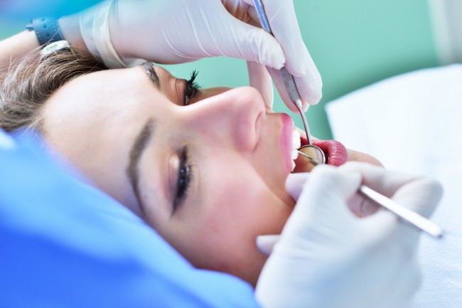 femeie care apeleaza la dentist pentru detartraj profesional