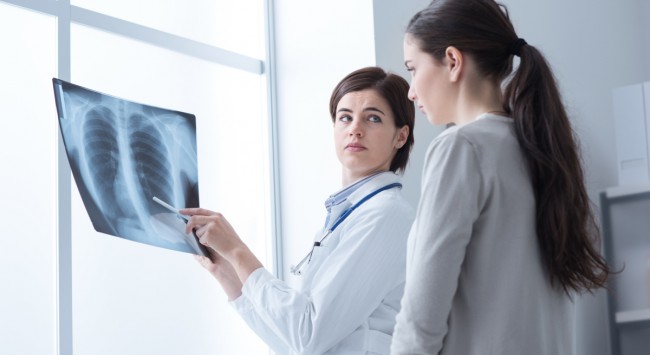 medic care examineaza o radiografie la plamani
