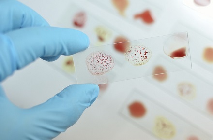 Sange ab4 grupa de sange ab pe o lamelă de microscop