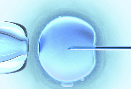 tehnici de fertilizare in vitro tratamentul infertilitatii