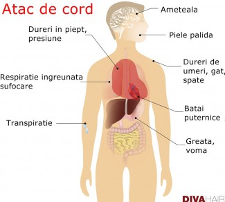 harta simptome atac de cord