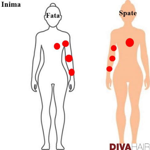 grafic durere radianta