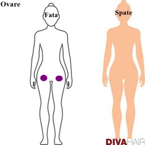 grafic durere radianta