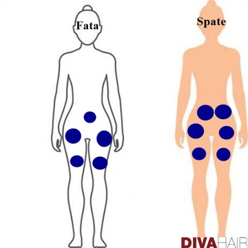 grafic durere radianta