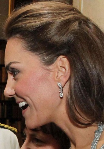 kate middleton cu cicatrice pe cap