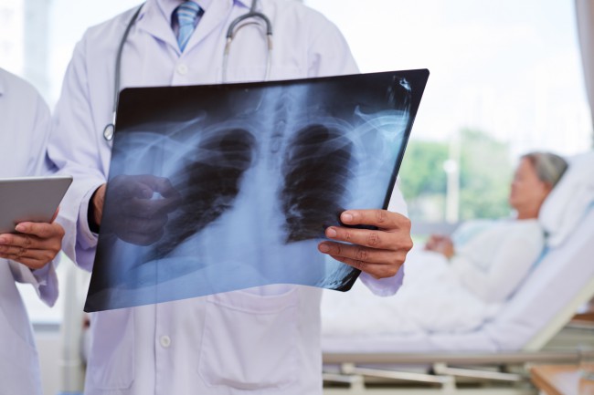 radiografie in mana unui medic