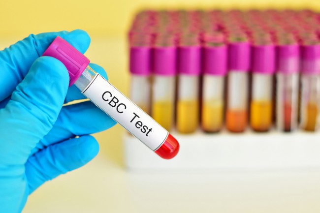 eritrocite mărite-test de sânge