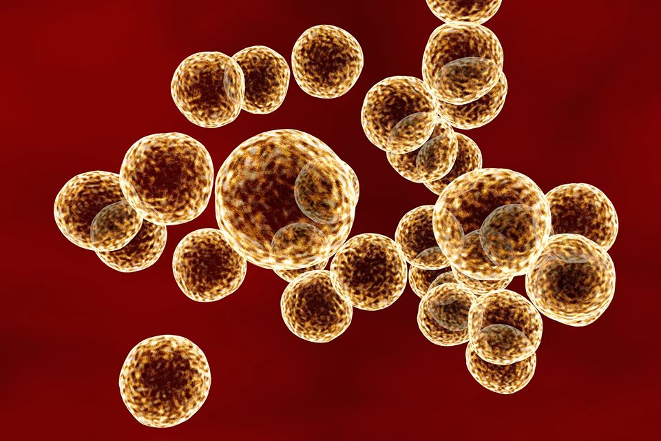 celulita infecțioasă-stafilococ auriu