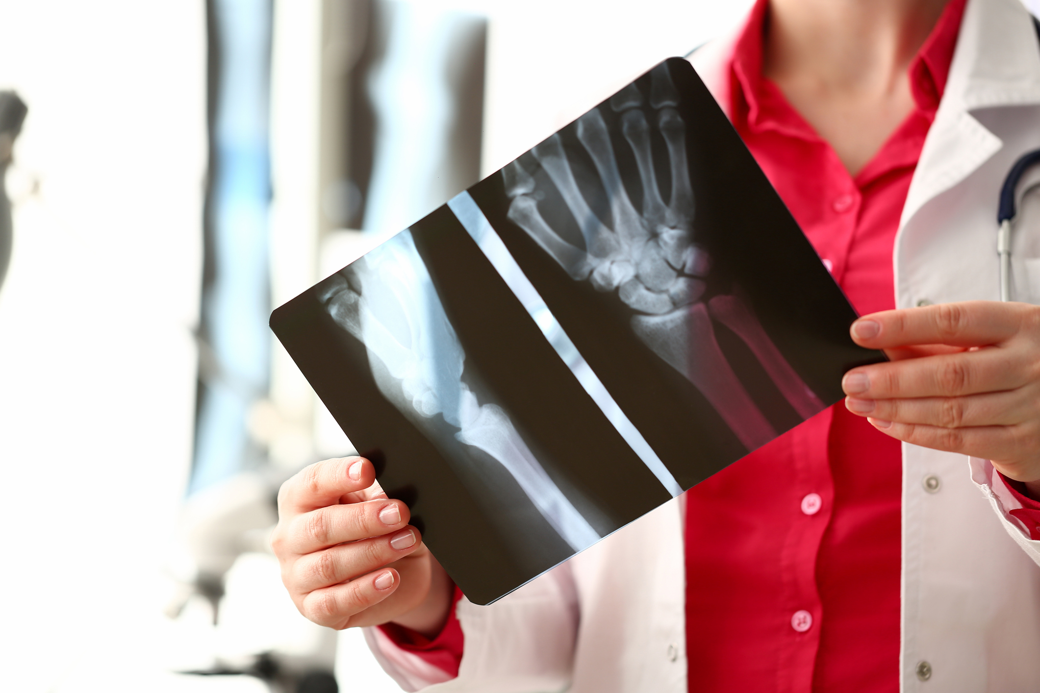 artroza mâinilor-diagnostic