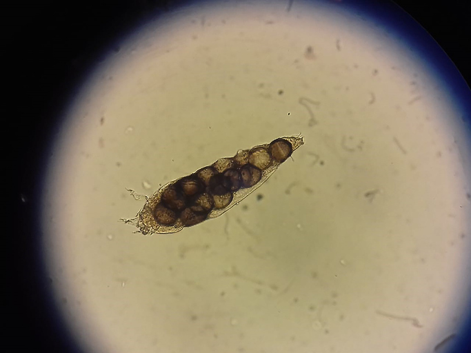 Demodex la microscop