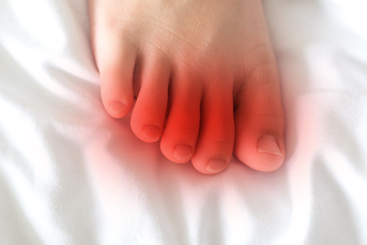 Femeie cu durere la degetele de la picioare