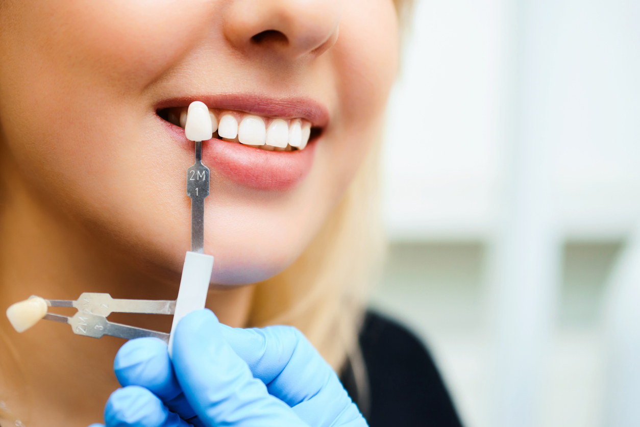 Femeie care își albește dinții la stomatolog