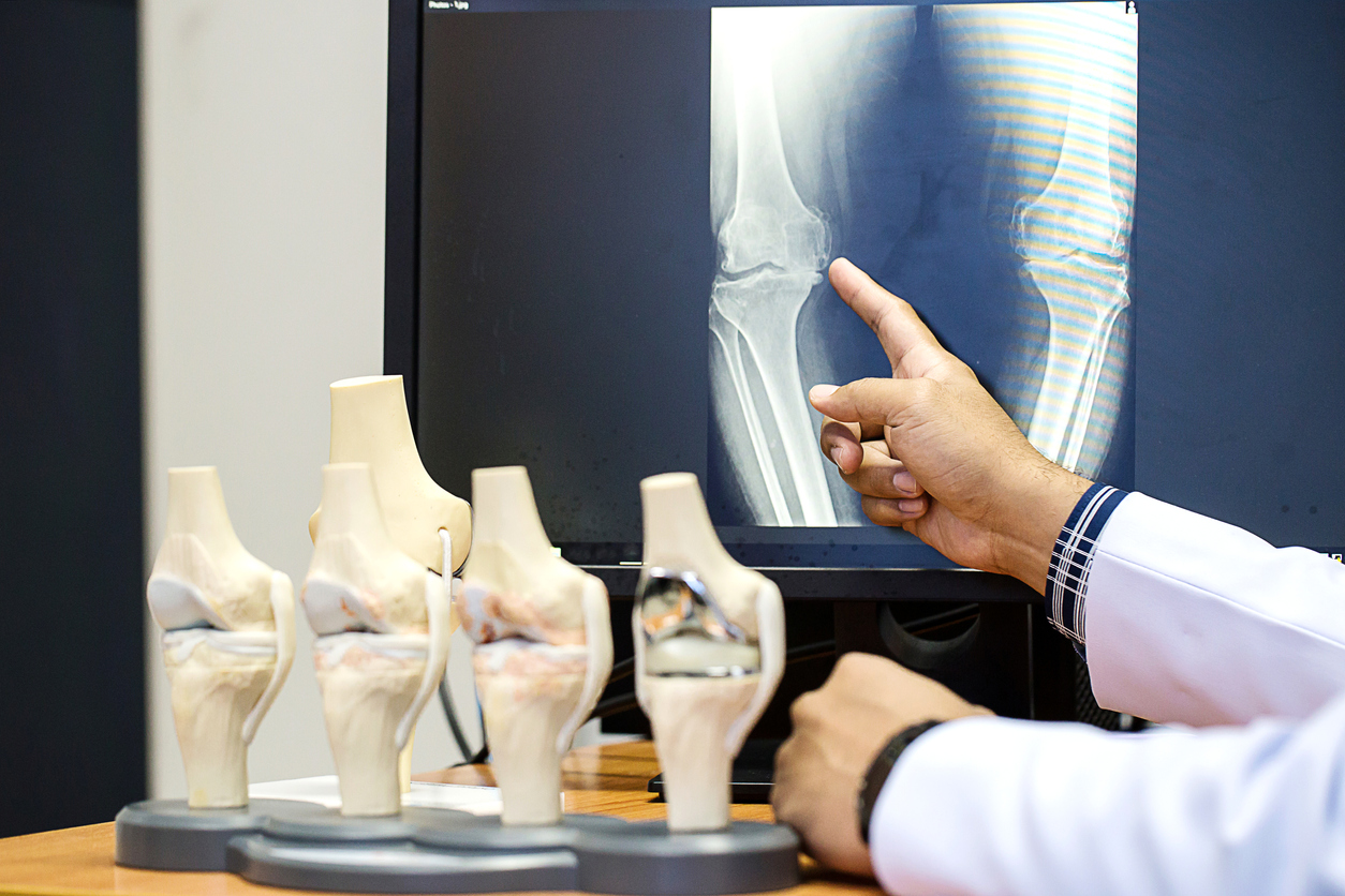 Doctor care se uită la o radiografie