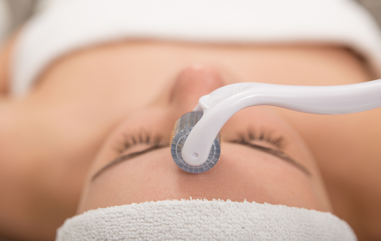 Femeie care își face tratament cu microneedle