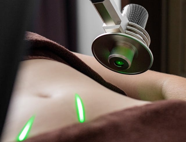 Laser pe abdomenul unei persoane