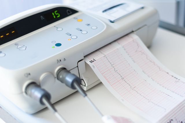 Aparat EKG